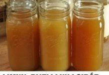 Napitak od jabukovog sirćeta, belog luka i limuna može ublažiti bol