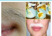 Ovaj recept obožavaju žene diljem svijeta jer učinkovito sprječava rast neželjenih dlačica, zbog čega brkovi nestaju kao da su ručno uklonjeni.