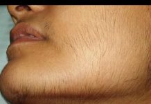 Maska od ove biljke može trajno ukloniti sve dlačice na licu: brzo zapišite recept, nakon čega kosa više neće rasti