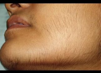 Maska od ove biljke može trajno ukloniti sve dlačice na licu: brzo zapišite recept, nakon čega kosa više neće rasti