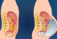 Ovo povrće može izazvati nadutost i plinove: izbjegavajte ovu namirnicu ako želite ravan trbuh