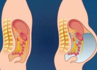 Ovo povrće može izazvati nadutost i plinove: izbjegavajte ovu namirnicu ako želite ravan trbuh