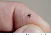 Krpelji se počinju buditi: Pomiješajte ova 2 SASTOJKA i nikada vas više neće dodirnuti!