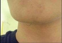 Imate li dlake na bradi? Evo šta to znači! Nije se pojavila bez razloga