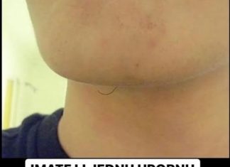 Imate li dlake na bradi? Evo šta to znači! Nije se pojavila bez razloga