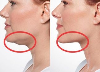 3 načina da izgubite veličinu podbratka bez pilula, injekcija ili operacije