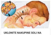 OSLOBDITE NAKUPINE SOLI NA VRATU: kako sam izliječio osteohondrozu bez skupih lijekova