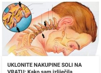 OSLOBDITE NAKUPINE SOLI NA VRATU: kako sam izliječio osteohondrozu bez skupih lijekova