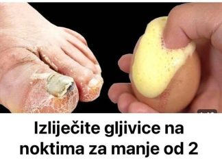 Izliječite gljivice na noktima za manje od 2 marke! Morate to učiniti!