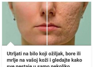 Obrišite sve ožiljke, bore ili mrlje na koži: svi će nestati u roku od nekoliko dana!