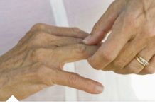 Kosti ne vole ovu hranu: ako jedete ovo, bolovi će biti jači, artritis će se pogoršati, zglobovi će se istrošiti…