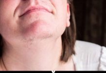 Znate li zašto ženama rastu dlake na bradi? To vam vaše tijelo govori