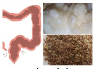 Očistite debelo crijevo ovim napitkom: pijte ga svaku večer prije spavanja i izbacite toksine