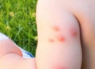 Jeste li znali da komarci mogu odabrati jedinke kao mete na temelju odjeće koju odluče nositi?