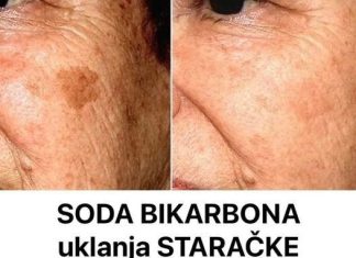 Koja je uloga sode bikarbone u liječenju mrlja na licu?