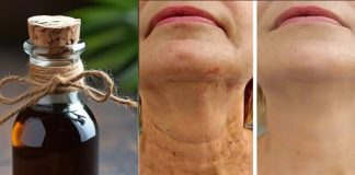 Ovo izvanredno ulje protiv starenja učinkovito smanjuje bore na licu s većom snagom od Botoxa.