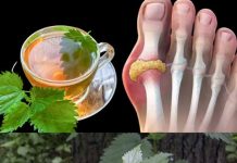 Čaj od koprive: organski lijek za smanjenje viška mokraćne kiseline – otkrijte način pripreme!