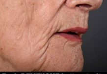 Potencijalni pokazatelj DEMENCIJE koji se može manifestirati oralno: Ako doživite ovo, preporučljivo je potražiti savjet liječnika.