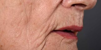 Potencijalni pokazatelj DEMENCIJE koji se može manifestirati oralno: Ako doživite ovo, preporučljivo je potražiti savjet liječnika.