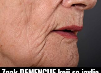 Potencijalni pokazatelj DEMENCIJE koji se može manifestirati oralno: Ako doživite ovo, preporučljivo je potražiti savjet liječnika.