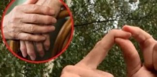 OBLOG KOJI IZVLAČI SAV BOL