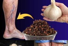 IZ KUHINJE 🧄🌿 NITKO NIJE VJEROVAO, A DANAS JE PROŠETALA KAO DA NIKAD NIJE BILA BOLESNA! 💪👣