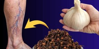 IZ KUHINJE 🧄🌿 NITKO NIJE VJEROVAO, A DANAS JE PROŠETALA KAO DA NIKAD NIJE BILA BOLESNA! 💪👣