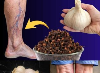 IZ KUHINJE 🧄🌿 NITKO NIJE VJEROVAO, A DANAS JE PROŠETALA KAO DA NIKAD NIJE BILA BOLESNA! 💪👣