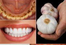 TAJNA KOJU STOMATOLOGI NE ŽELE OTKRITI: UKLONITE KAMENAC I IZBIJELITE ZUBE ZA SAMO 2 MINUTE!** 😲