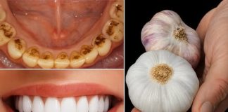 TAJNA KOJU STOMATOLOGI NE ŽELE OTKRITI: UKLONITE KAMENAC I IZBIJELITE ZUBE ZA SAMO 2 MINUTE!** 😲