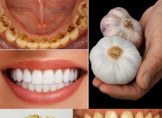 TAJNA KOJU STOMATOLOGI NE ŽELE OTKRITI: UKLONITE KAMENAC I IZBIJELITE ZUBE ZA SAMO 2 MINUTE!** 😲