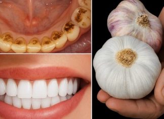 🦷✨ TAJNA KOJU STOMATOLOZI NE ŽELE OTKRITI: UKLONITE KAMENAC I IZBIJELITE ZUBE ZA SAMO 2 MINUTE!** 😲 🦷✨ TAJNA KOJU STOMATOLOZI NE ŽELE OTKRITI: UKLONITE KAMENAC I IZBIJELITE ZUBE ZA SAMO 2 MINUTE!** 😲 - featured image