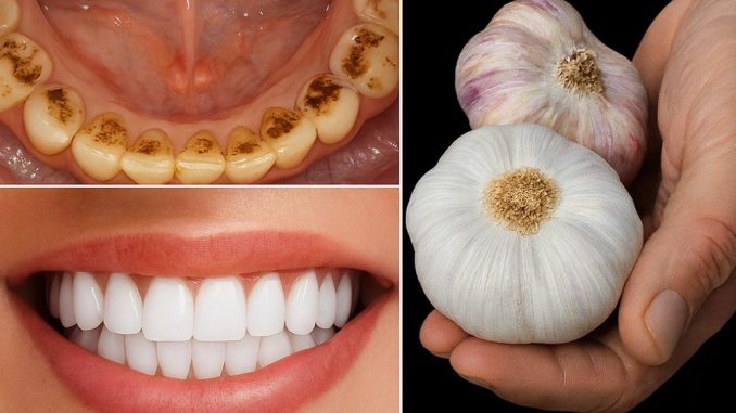 🦷✨ TAJNA KOJU STOMATOLOZI NE ŽELE OTKRITI: UKLONITE KAMENAC I IZBIJELITE ZUBE ZA SAMO 2 MINUTE!** 😲 - featured image 🦷✨ TAJNA KOJU STOMATOLOZI NE ŽELE OTKRITI: UKLONITE KAMENAC I IZBIJELITE ZUBE ZA SAMO 2 MINUTE!** 😲 - featured image