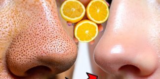 12 ČUDESNIH BEAUTY MOĆI LIMUNA 🍋 – Prirodni recepti za savršeno blistavu kožu 12 ČUDESNIH BEAUTY MOĆI LIMUNA 🍋 – Prirodni recepti za savršeno blistavu kožu - featured image