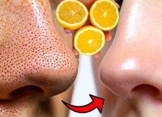 12 ČUDESNIH BEAUTY MOĆI LIMUNA 🍋 – Prirodni recepti za savršeno blistavu kožu 12 ČUDESNIH BEAUTY MOĆI LIMUNA 🍋 – Prirodni recepti za savršeno blistavu kožu - featured image
