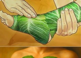 Listovi kupusa na prsima: Prirodni lijek za zagušenje i ublažavanje kašlja – Listovi kupusa na prsima: Prirodni lijek za zagušenje i ublažavanje kašlja - - featured image