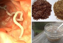 🌿 PRIRODNI RECEPT ZA ČIŠĆENJE CRIJEVA OD PARAZITA** ✨🧄 🌿 PRIRODNI RECEPT ZA ČIŠĆENJE CRIJEVA OD PARAZITA** ✨🧄 - featured image