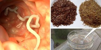 🌿 PRIRODNI RECEPT ZA ČIŠĆENJE CRIJEVA OD PARAZITA** ✨🧄 🌿 PRIRODNI RECEPT ZA ČIŠĆENJE CRIJEVA OD PARAZITA** ✨🧄 - featured image