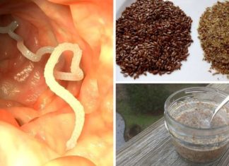 🌿 PRIRODNI RECEPT ZA ČIŠĆENJE CRIJEVA OD PARAZITA** ✨🧄 🌿 PRIRODNI RECEPT ZA ČIŠĆENJE CRIJEVA OD PARAZITA** ✨🧄 - featured image