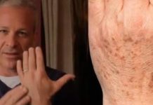 Sok od luka + jabukovo sirće: Samo pomiješajte i riješite se staračkih pjega na rukama, licu i dekolteu jednom za svagda! Sok od luka + jabukovo sirće: Samo pomiješajte i riješite se staračkih pjega na rukama, licu i dekolteu jednom za svagda! - featured image