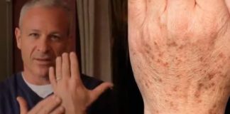 Sok od luka + jabukovo sirće: Samo pomiješajte i riješite se staračkih pjega na rukama, licu i dekolteu jednom za svagda! Sok od luka + jabukovo sirće: Samo pomiješajte i riješite se staračkih pjega na rukama, licu i dekolteu jednom za svagda! - featured image