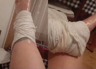 NAMAZALA LIST GAVEZA I UMOTALA BOLNI ZGLOB A ZATIM LEGLA SPAVATI NAMAZALA LIST GAVEZA I UMOTALA BOLNI ZGLOB A ZATIM LEGLA SPAVATI - featured image