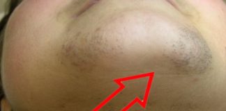 ZNATE LI ZAŠTO SE KOD ŽENA JAVLJAJU DLAČICE NA BRADI? Evo šta vam organizam govori ZNATE LI ZAŠTO SE KOD ŽENA JAVLJAJU DLAČICE NA BRADI? Evo šta vam organizam govori - featured image