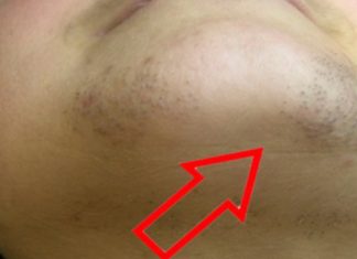 ZNATE LI ZAŠTO SE KOD ŽENA JAVLJAJU DLAČICE NA BRADI? Evo šta vam organizam govori ZNATE LI ZAŠTO SE KOD ŽENA JAVLJAJU DLAČICE NA BRADI? Evo šta vam organizam govori - featured image