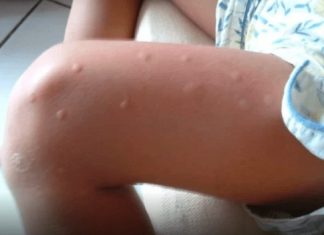 KOMARCI VAM PRAVE PAKAO OD ŽIVOTA? Samo isijecite OVO VOĆE na pola i ostavite u sobi, VIŠE IH NIKADA NEĆETE VIDJETI BLIZU! KOMARCI VAM PRAVE PAKAO OD ŽIVOTA? Samo isijecite OVO VOĆE na pola i ostavite u sobi, VIŠE IH NIKADA NEĆETE VIDJETI BLIZU! - featured image