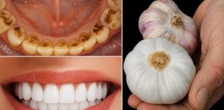 🦷✨ TAJNA KOJU STOMATOLOZI NE ŽELE OTKRITI: UKLONITE KAMENAC I IZBIJELITE ZUBE ZA SAMO 2 MINUTE!** 😲 🦷✨ TAJNA KOJU STOMATOLOZI NE ŽELE OTKRITI: UKLONITE KAMENAC I IZBIJELITE ZUBE ZA SAMO 2 MINUTE!** 😲 - featured image