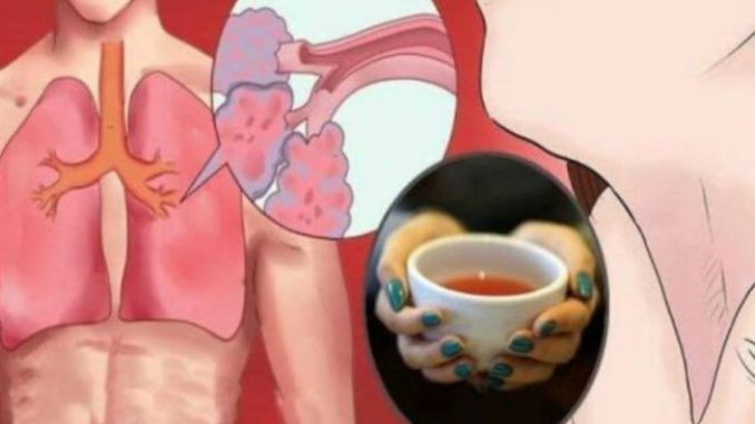 ISPRALA JE KATRAN SA PLUĆA ZA SAMO 72 SATA I DOKTORI SU BILI U ČUDU: Ovaj napitak čisti organizam! - featured image ISPRALA JE KATRAN SA PLUĆA ZA SAMO 72 SATA I DOKTORI SU BILI U ČUDU: Ovaj napitak čisti organizam! - featured image