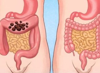 Popijte samo jednu čašu prije spavanja da biste očistili cijelo debelo crijevo za 10 minuta Popijte samo jednu čašu prije spavanja da biste očistili cijelo debelo crijevo za 10 minuta - featured image