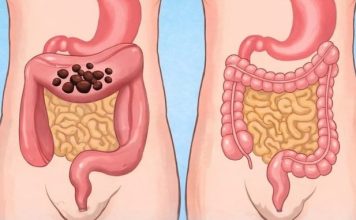 Popijte samo jednu čašu prije spavanja da biste očistili cijelo debelo crijevo za 10 minuta Popijte samo jednu čašu prije spavanja da biste očistili cijelo debelo crijevo za 10 minuta - featured image