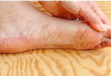 7 znakova da se tijelo već duže vrijeme bori s VISOKIM ŠEĆEROM UKRVI: Prvo ćete to primijetiti na očima i nogama! 7 znakova da se tijelo već duže vrijeme bori s VISOKIM ŠEĆEROM UKRVI: Prvo ćete to primijetiti na očima i nogama! - featured image